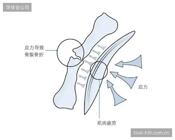 当“更快”成为唯一诉求，为何精英跑者们反而开始批量遭遇应力性骨折？